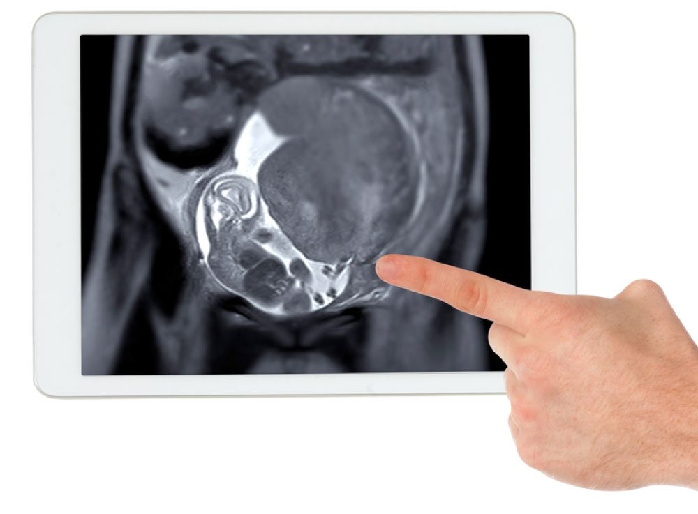 Image hover effect image