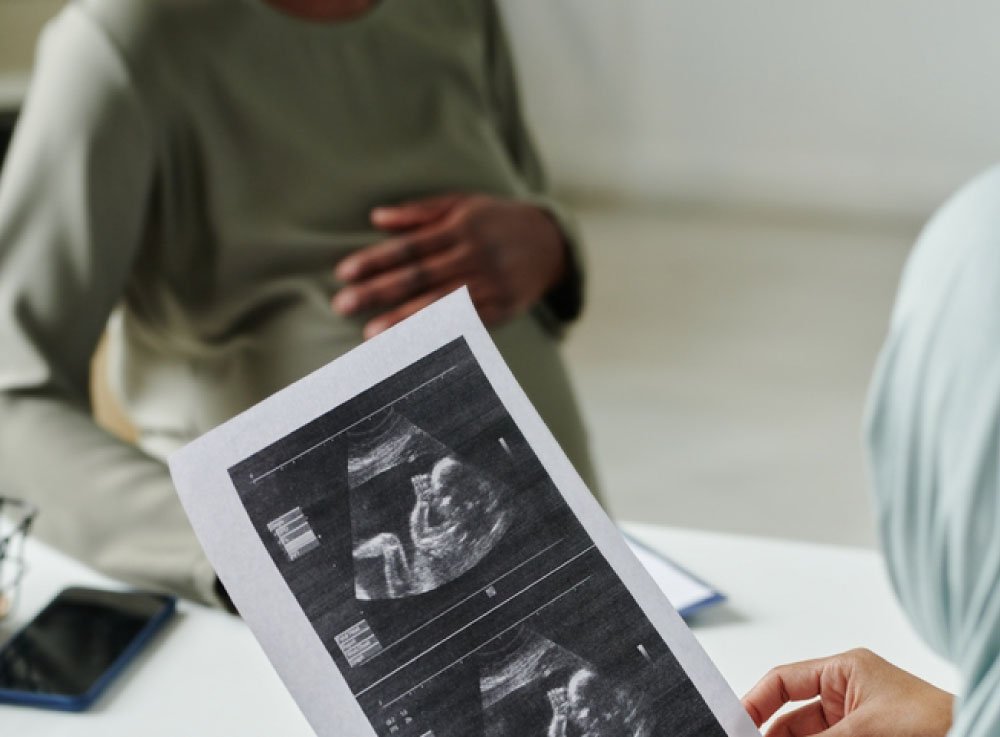 Image hover effect image