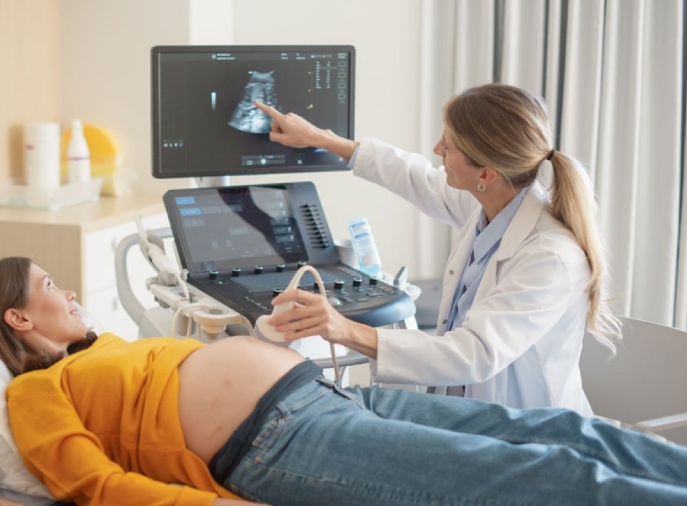 Image hover effect image