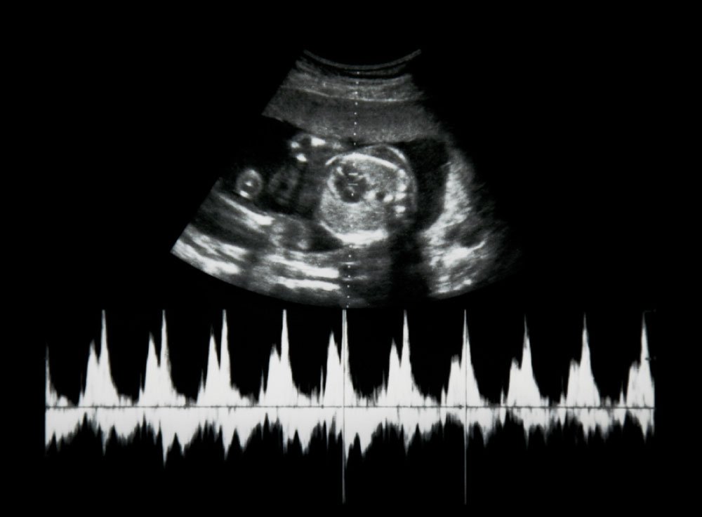 Image hover effect image