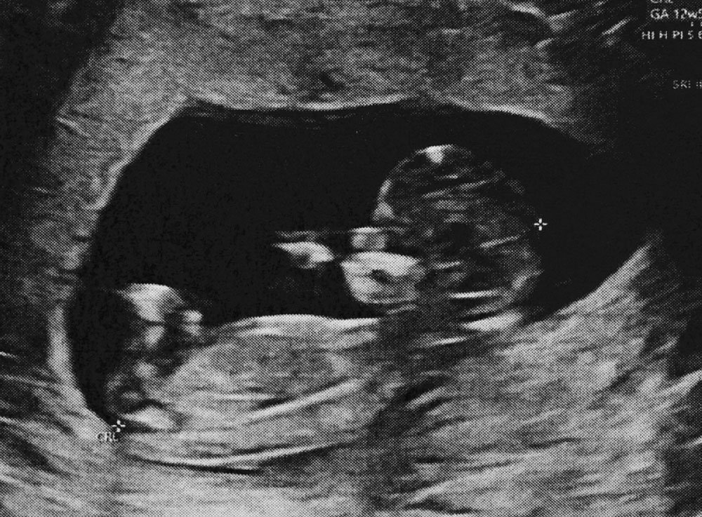 Image hover effect image