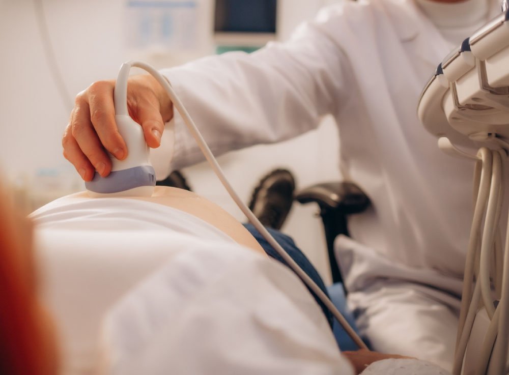 Image hover effect image