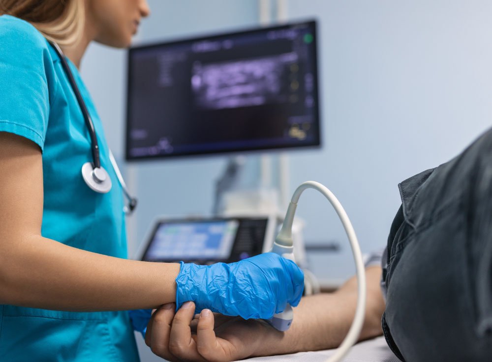 Image hover effect image