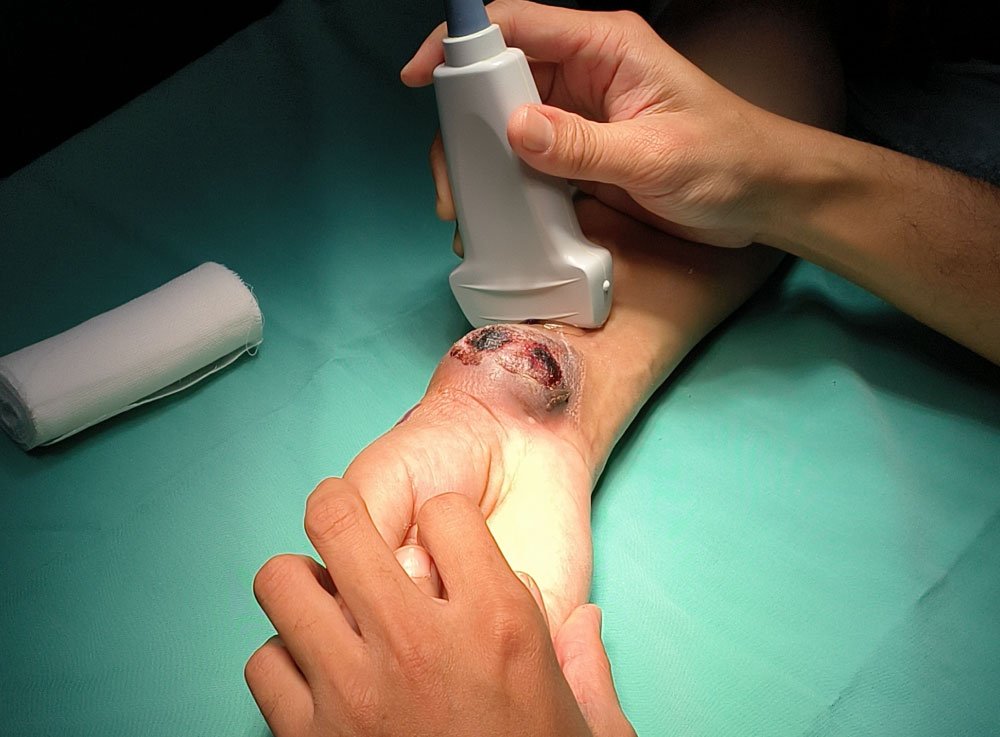 Image hover effect image