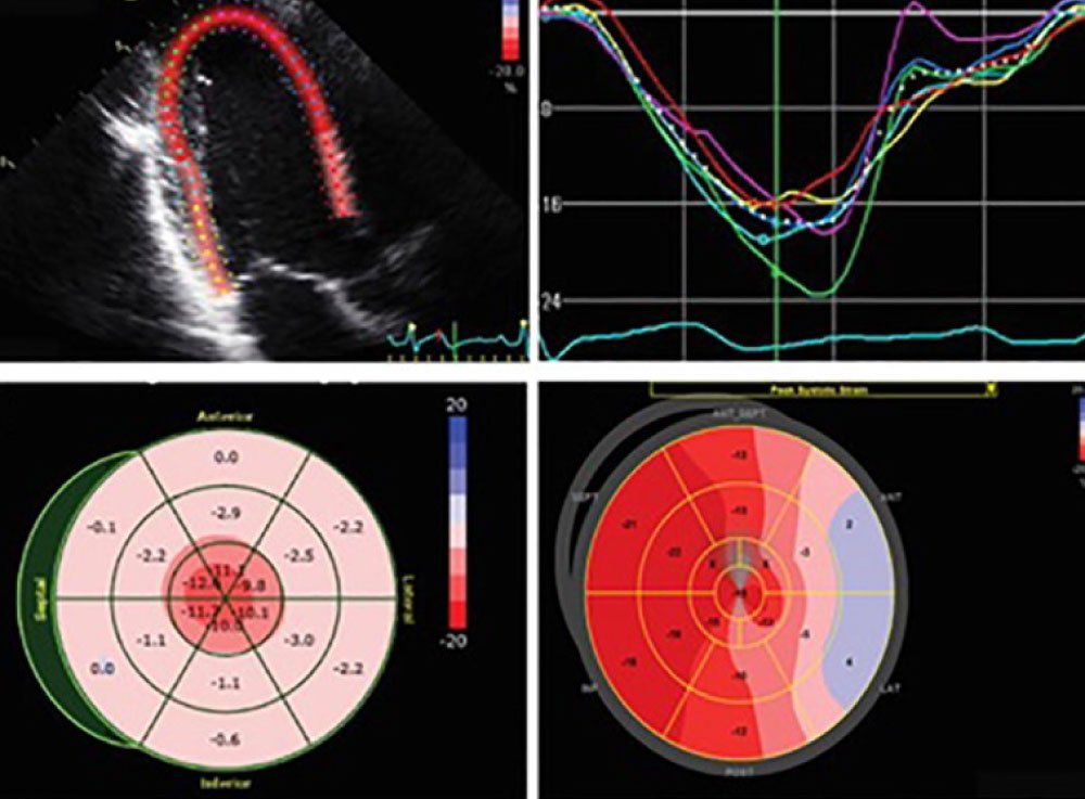 Image hover effect image