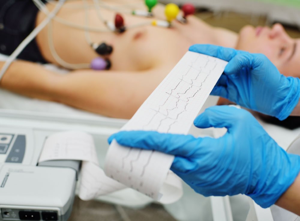 Image hover effect image