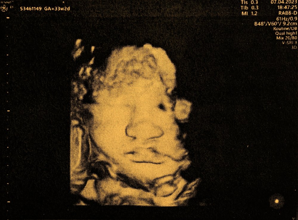 Image hover effect image